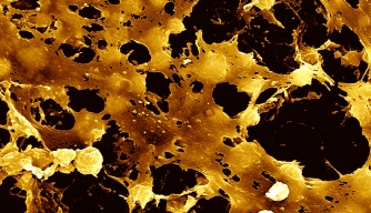 Researchers Use Medieval Remedy to Kill Modern Superbug