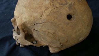 Perforated Skulls From Middle Ages Found in Spain
