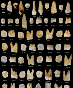Human upper teeth found from the Fuyan Cave, Daoxian. (Credit: S. Xing)