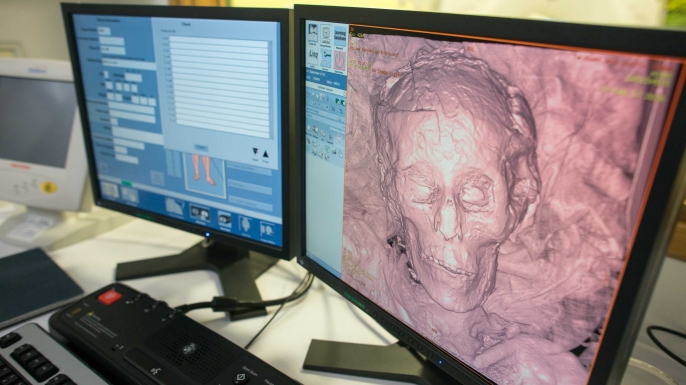 Scanning the 2,700-year-old mummy, Ta-Kush, at KIMS Hospital. (Credit: Paul Dixon)