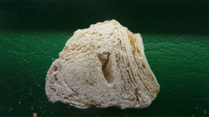 A cross section (measured in centimeters) of a calcified nodule found in a skeleton dating to Byzantine Troy. (Credit: PATHOLOGIE NORDHESSEN)
