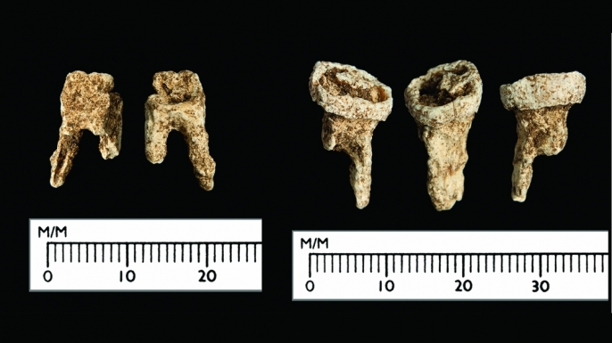 The Viking's teeth. (Credit: Antiquity Publications Ltd, 2017)