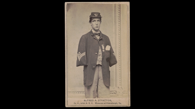 Alfred A. Stratton of Co. G, 147th New York Infantry Regiment who lost his arms on on June 18, 1864, at Petersburg, Virginia. (Credit: The Library of Congress)