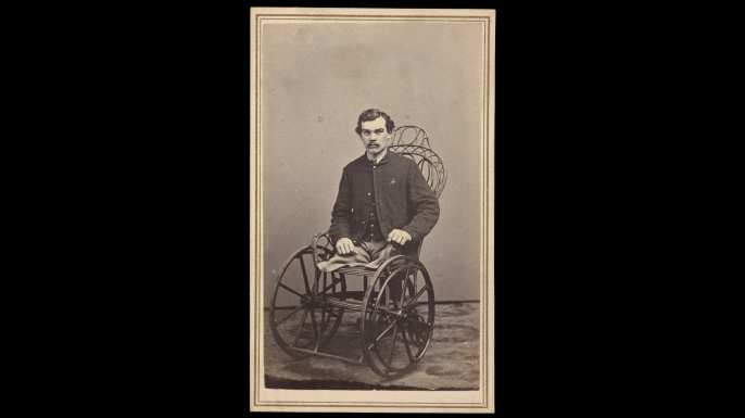 Corporal Michael Dunn of Co. H, 46th Pennsylvania Infantry Regiment, after the amputation of his legs in 1864, the result of injuries received in a battle near Dallas, Georgia, on May 25, 1864. (Credit: The Library of Congress)
